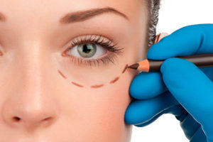 clínica de cirugía estética en Madrid blefaroplastia - cirugía facial madrid - Dra. Ainhoa Placer